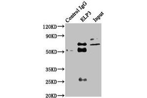 Immunoprecipitating ELP3 in HEK293 whole cell lysate Lane 1: Rabbit control IgG instead of ABIN7151580 in HEK293 whole cell lysate. (ELP3/KAT9 anticorps  (AA 1-85))