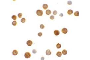 anti-Chromosome 2 Open Reading Frame 40 (C2orf40) (C-Term) antibody