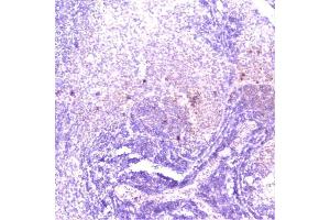 IHC analysis of TANK using anti-TANK antibody (ABIN6719508). (TANK anticorps)