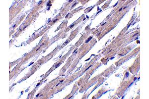 Immunohistochemistry (IHC) image for anti-BCL2-Like 13 (Apoptosis Facilitator) (BCL2L13) (Middle Region) antibody (ABIN1030885) (BCL2L13 anticorps  (Middle Region))