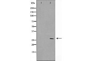 Western blot analysis on HuvEc cell lysate using SIX6 Antibody，The lane on the left is treated with the antigen-specific peptide. (SIX Homeobox 6 anticorps  (Internal Region))