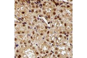 Immunohistochemical analysis of E6AP staining in rat kidney formalin fixed paraffin embedded tissue section. (ube3a anticorps)