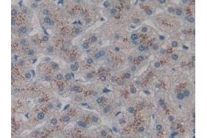 Detection of CD301 in Human Liver Tissue using Polyclonal Antibody to Cluster Of differentiation 301 (CD301)