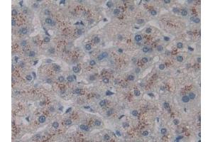 Detection of CD301 in Human Liver Tissue using Polyclonal Antibody to Cluster Of differentiation 301 (CD301) (CLEC10A anticorps  (AA 71-239))