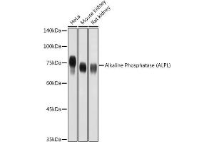 Western blot analysis of extracts of various cell lines, using Alkaline Phosphatase (ALPL) antibody (ABIN3021385, ABIN3021386, ABIN1512569 and ABIN6214987) at 1:1000 dilution.