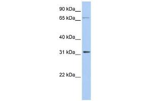 IDI1 antibody used at 1 ug/ml to detect target protein.