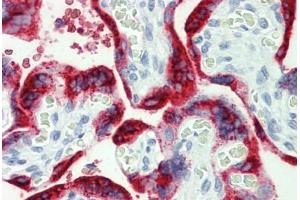 Human Placenta: Formalin-Fixed, Paraffin-Embedded (FFPE)