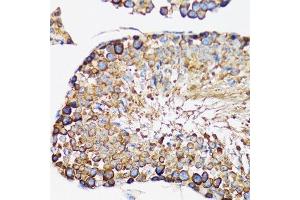 Immunohistochemistry of paraffin-embedded rat testis using IRAK4 antibody.