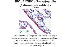 Image no. 2 for anti-Synaptopodin (SYNPO) (C-Term) antibody (ABIN1739830)