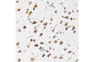 Immunohistochemistry of paraffin-embedded rat brain using eIF2B epsilon (EIF2B5) (EIF2B5) Rabbit mAb (ABIN7267038) at dilution of 1:100 (40x lens).