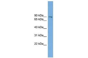 UTP14A antibody used at 1 ug/ml to detect target protein. (UTP14A anticorps)