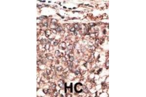 Immunohistochemistry (IHC) image for anti-Platelet Derived Growth Factor D (PDGFD) antibody (ABIN3002574) (PDGFD anticorps)