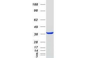 Validation with Western Blot