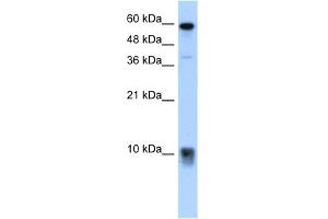 WB Suggested Anti-S100A3 Antibody Titration:  5. (S100A3 anticorps  (N-Term))