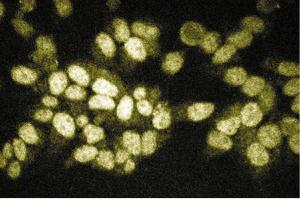 Immunofluorescent staining of HeLa cells. (RIPK2 anticorps  (AA 333-532))