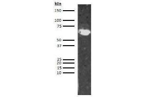 Western Blotting (WB) image for anti-Low Molecular Weight Kininogen (LMWK) antibody (Biotin) (ABIN613239) (LMW Kininogen anticorps  (Biotin))