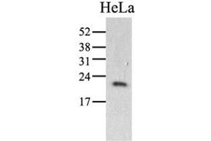 The HeLa (40ug) were resolved by SDS-PAGE, transferred to PVDF membrane and probed with anti-human PPIC antibody (1:1000). (PPIC anticorps)