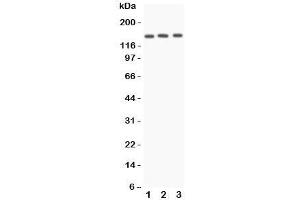 Western blot testing of Angiotensin Converting Enzyme antibody and Lane 1:  A549;  2: HeLa;  3: 22RV1 lysate.