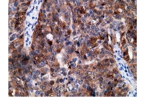 Immunohistochemical staining of paraffin-embedded Human colon tissue using anti-EPHX2 mouse monoclonal antibody. (EPHX2 anticorps)