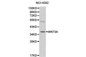 Western Blotting (WB) image for anti-Wingless-Type MMTV Integration Site Family, Member 3A (WNT3A) antibody (ABIN1875351) (WNT3A anticorps)