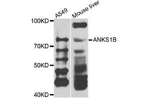 Western blot analysis of extracts of A549 and mouse liver cells, using ANKS1B antibody. (ANKS1B anticorps)