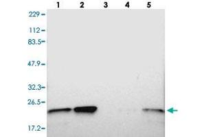 Western blot analysis of Lane 1: RT-4, Lane 2: U-251 MG, Lane 3: Human Plasma, Lane 4: Liver, Lane 5: Tonsil with TAGLN2 polyclonal antibody  at 1:250-1:500 dilution.
