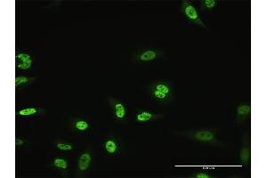 Immunofluorescence of monoclonal antibody to MZF1 on HeLa cell. (MZF1 anticorps  (AA 419-518))
