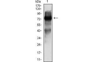 Western blot analysis using SOX11 mouse mAb against Y-79 (1) cell lysate.