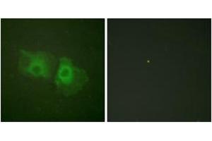 Immunofluorescence analysis of HeLa cells, using Keratin 18 (Ab-33) Antibody. (Cytokeratin 18 anticorps  (AA 1-50))