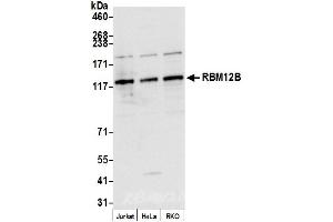 anti-RNA Binding Motif Protein 12B (RBM12B) (AA 600-650) antibody