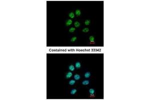 ICC/IF Image Immunofluorescence analysis of paraformaldehyde-fixed A431, using ZNF143, antibody at 1:500 dilution. (ZNF143 anticorps  (C-Term))