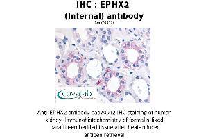 Image no. 1 for anti-Epoxide Hydrolase 2, Cytoplasmic (EPHX2) (Internal Region) antibody (ABIN1734089) (EPHX2 anticorps  (Internal Region))