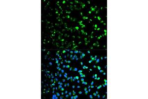 Immunofluorescence analysis of HeLa cells using TYMP antibody.