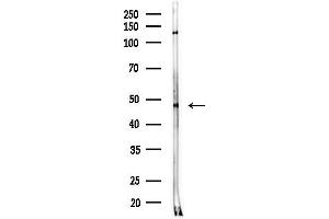 Western blot analysis of lysates from MDA-MB-231 cells(heat-shock,45 min treatment), using ABH Antibody at 1/1000 dilution.