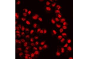 IF analysis of WAPL/FOE using anti-WAPL/FOE antibody (ABIN7602663). (WAPAL anticorps  (AA 916-1190))