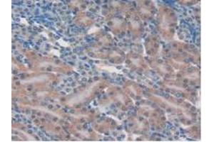 Detection of MAPK7 in Mouse Kidney Tissue using Polyclonal Antibody to Mitogen Activated Protein Kinase 7 (MAPK7)