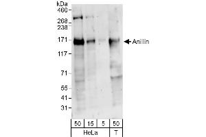 Western Blotting (WB) image for anti-Anillin, Actin Binding Protein (ANLN) (AA 1074-1124) antibody (ABIN7454747) (Anillin anticorps  (AA 1074-1124))
