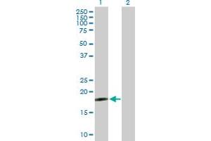 Western Blot analysis of DNAJC5G expression in transfected 293T cell line by DNAJC5G MaxPab polyclonal antibody.