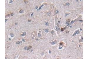 Detection of SEMA3E in Human Cerebrum Tissue using Polyclonal Antibody to Semaphorin 3E (SEMA3E)