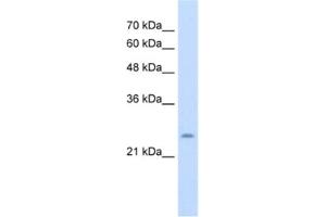 Western Blotting (WB) image for anti-Cysteine-Rich Hydrophobic Domain 1 (CHIC1) antibody (ABIN2463993) (CHIC1 anticorps)