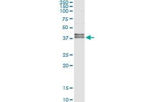 FAS (Human) IP-WB Antibody Pair