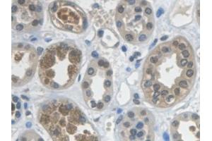 Detection of GAPDH in Human Kidney Tissue using Monoclonal Antibody to Glyceraldehyde-3-Phosphate Dehydrogenase (GAPDH)