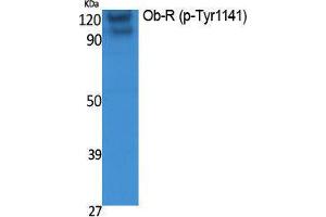 Western Blotting (WB) image for anti-Leptin Receptor (LEPR) (pTyr1141) antibody (ABIN3183068)