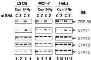 Anti-ZBP-89 antibody used to confirm siRNA knockdown of ZBP-89.