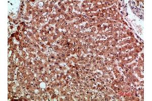 Immunohistochemical analysis of paraffin-embedded human-liver, antibody was diluted at 1:200