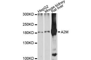 Western blot analysis of extracts of various cell lines, using A2M antibody. (alpha 2 Macroglobulin anticorps)