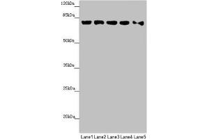 Western blot All lanes: MCCC1 antibody at 0. (MCCC1 anticorps  (AA 526-725))