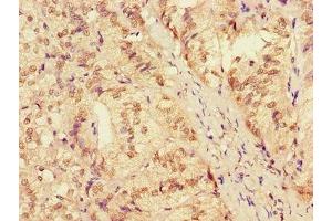 Immunohistochemistry of paraffin-embedded human adrenal gland tissue using ABIN7150120 at dilution of 1:100 (ZRANB3 anticorps  (AA 370-624))