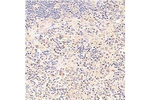 Immunohistochemistry analysis of paraffin-embedded rat spleen using,Tal1 (ABIN7075819) at dilution of 1: 1500 (TAL1 anticorps)