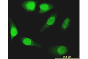 Immunofluorescence of monoclonal antibody to FOXO1 on HeLa cell. (FOXO1 anticorps  (AA 452-555))